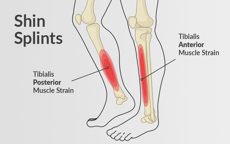 Rewind: Why shin splints are well used in muay thai – BOEC.COM